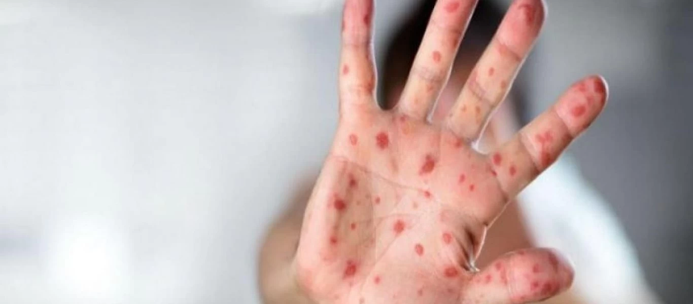 Aυτά τα σημάδια του καρκίνου αγνοούν όλοι